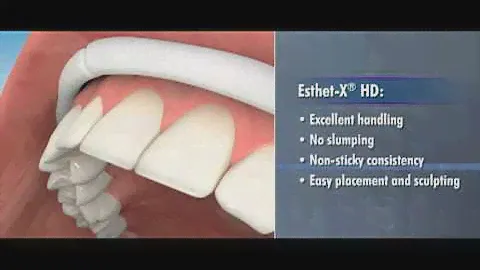 Esthet-X® HD—The High-Definition Matrix for Artful Restorations: Chapter 5 | Dentsply Sirona